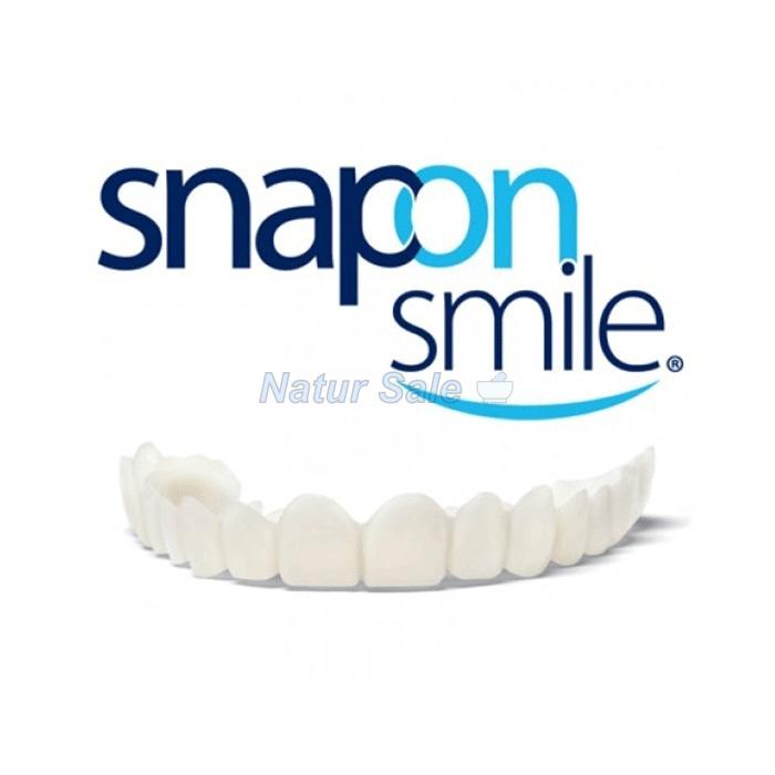 ☆ Snap-On Smile - veneers